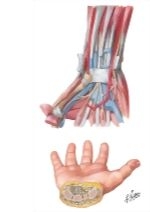 Flexor Tendons