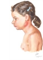 Child With Bacterial Cervical Lymphadenitis
