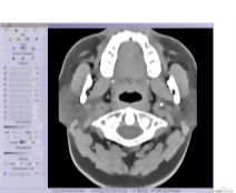 Imaging Software