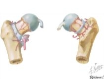 Arteries: Arteries of the Femoral Neck