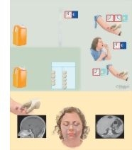 Tests Used In the Diagnosis of Cushing Syndrome