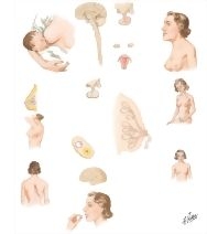 Galactorrhea