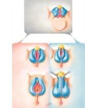 Homologues of External Genitalia