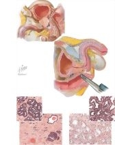 Carcinoma of Prostate III: Diagnosis, Treatment, and Palliation