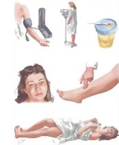 Preeclampsia: Symptoms