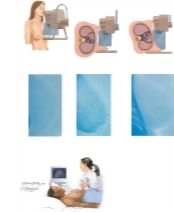 Breast Imaging