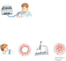 Bronchial Asthma