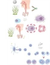 Bronchial Asthma