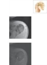 Cross Section of the Shoulder: Axial View