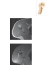 Cross Section of the Upper Arm: Axial View