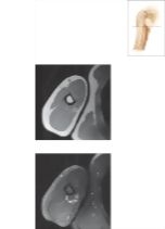 Cross Section of the Arm: Axial View