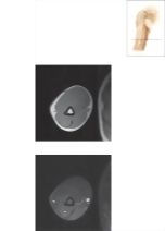 Cross Section of the Arm: Axial View