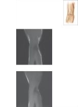 Cross Section of the Elbow: Sagittal View