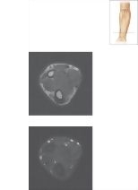 Cross Section of the Forearm: Axial View