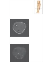 Cross Section of the Forearm: Axial View