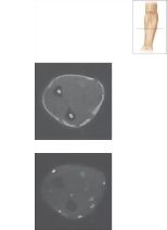 Cross Section of the Forearm: Axial View