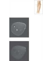 Cross Section of the Forearm: Axial View