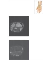 Cross Section of the Wrist: Axial View
