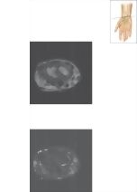 Cross Section of the Wrist: Axial View