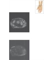 Cross Section of the Wrist: Axial View