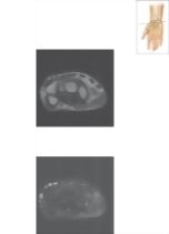 Cross Section of the Wrist: Axial View