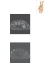 Cross Section of the Wrist: Axial View