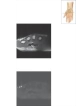 Cross Section of the Wrist: Axial View