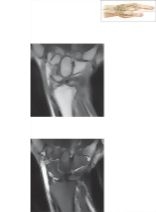 Cross Section of the Wrist: Coronal View