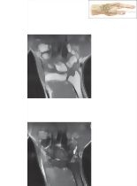 Cross Section of the Wrist: Coronal View