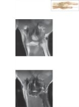 Cross Section of the Wrist: Coronal View