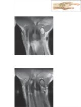 Cross Section of the Wrist: Coronal View