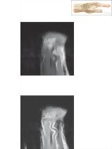 Cross Section of the Wrist: Coronal View
