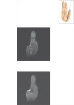 Cross Section of the Thumb: Coronal View