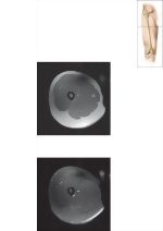 Cross Section of the Thigh: Axial View