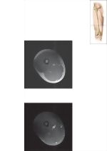 Cross Section of the Thigh: Axial View