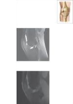 Cross Section of the Knee: Sagittal View