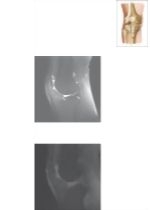 Cross Section of the Knee: Sagittal View