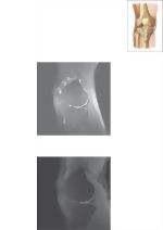 Cross Section of the Knee: Sagittal View
