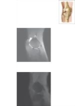 Cross Section of the Knee: Sagittal View