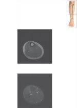 Cross Section of the Lower Leg: Axial View