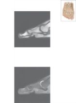 Cross Section of the Plantar Plate: Sagittal View