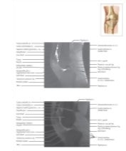 Major image