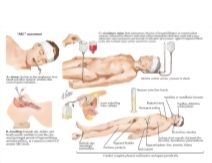 Jones 2E image