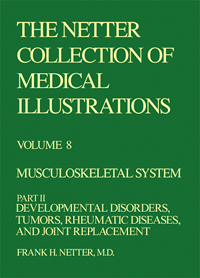 The Netter Collection of Medical Illustrations - Musculoskeletal System, Part II - Developmental Disorders, Tumors, Rheumatic Diseases and Joint Replacements
