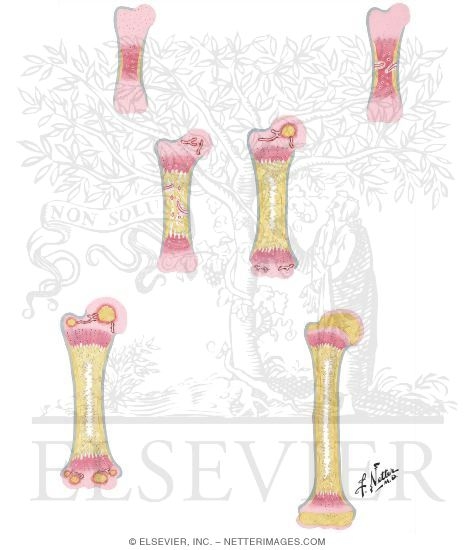 Growth and Ossification of Long Bones (Humerus, Midfrontal Sections)
Endochondral Ossification In a Long Bone
