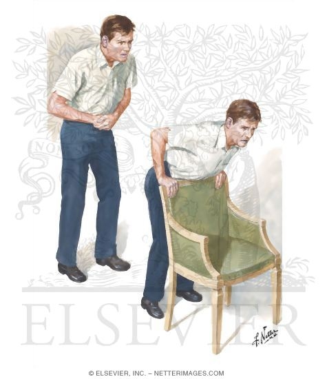 Heimlich Maneuver Techniques: Self-save procedure