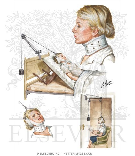 Home Treatment for Cervical Injuries
