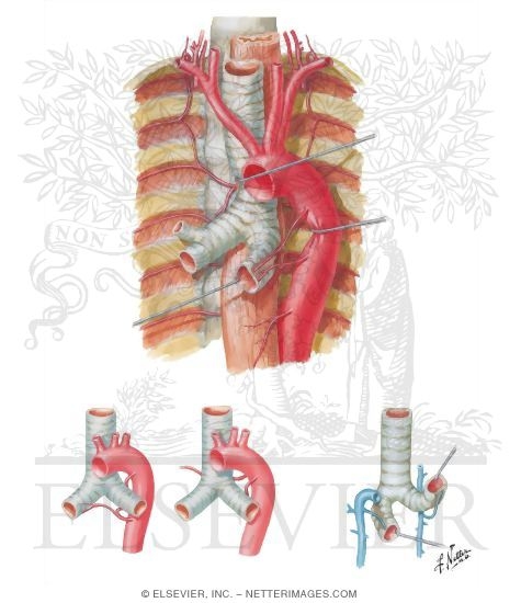 Bronchial Arteries and Veins