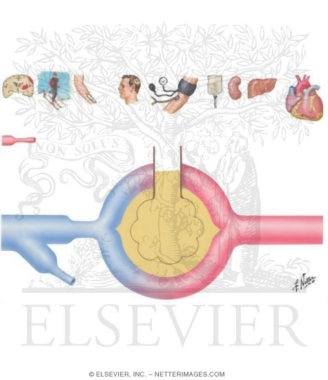 Watermarked preview of unlabeled image: Pulmonary Edema; Some Etiologies and Hypotheses of Mechanisms