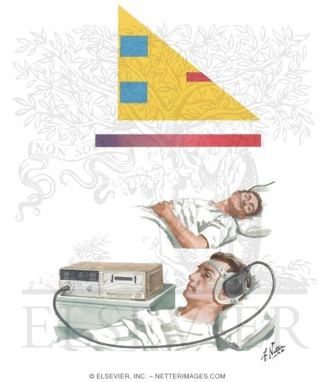 Watermarked preview of unlabeled image: Oxygen Therapy in Acute Respiratory Failure